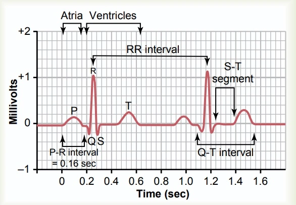 Understanding Normal ECG From Waves to Wellness - Amit Shrivastava